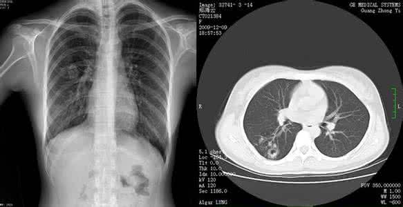 一图读懂 一图读懂：X光、CT、MR、超声！