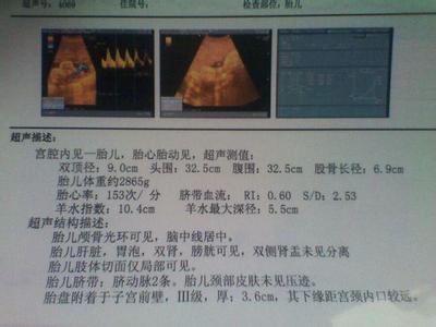 孕期胎儿排畸筛查 做大排畸检查的医生 通过B超筛查胎儿有无畸形