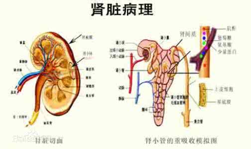 过敏性紫癜的发病机制 过敏性紫癜的发病机制 过敏性阴道炎的发病机制