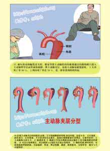 社区常见疾病健康宣教 图解:健康解码 | 常见疾病——高血压