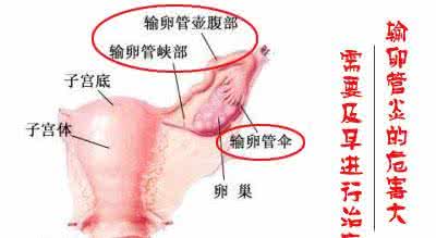 外阴瘙痒潮湿怎么办 外阴瘙痒怎么办 如何正确对待外阴瘙痒