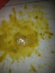 两岁宝宝拉稀水怎么办 两岁宝宝拉稀什么原因 两岁宝宝拉肚子的原因