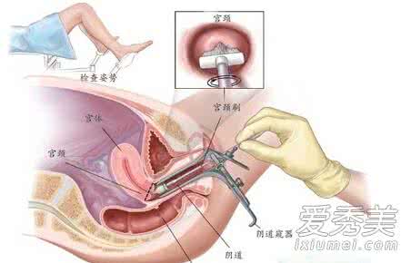 妇科检查包括哪些项目 妇科检查包括哪些项目 妇科检查的项目都有哪些