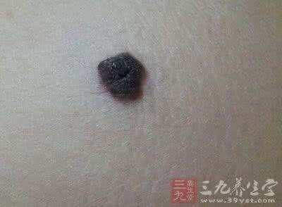 如何让心脏更健康 海外医话：一个月让心脏更健康