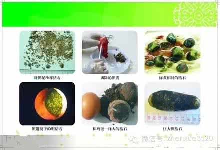肝胆排毒的最佳方法 肝胆排毒的最佳方法 科学饮食 简易排毒的最佳方法