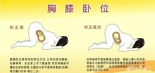 胎位不正应该怎么睡觉 胎位不正的原因