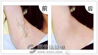 永久脱毛反弹吗 怎么才能永久脱毛 怎么样才能永久脱毛不反弹呢?