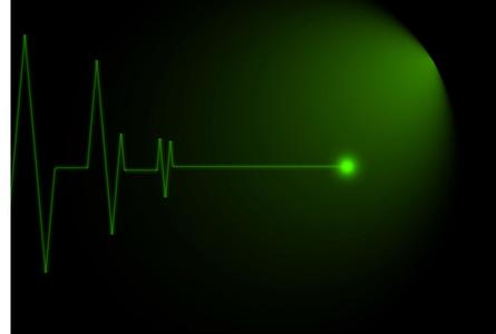 心电图图片大全 心电图的图片