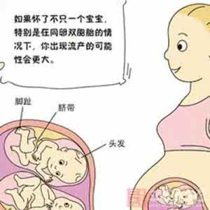 腹股沟疝发病率 腹内抢营养双胞胎都没了 双胎胎发病率更高