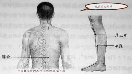 艾灸祛湿 常祛湿，试试火罐和艾（灸）草