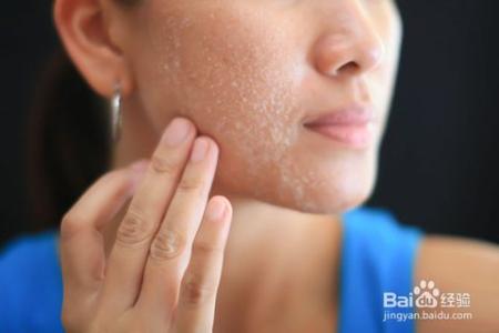 如何清洁毛孔 清洁毛孔 如何清洁毛孔