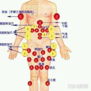 拔罐减肥的原理是什么 拔罐减肥的原理是什么 健康减肥原理是什么