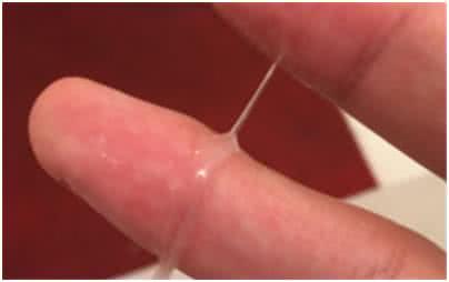排卵期白带褐色 备孕排卵期白带褐色怎么办