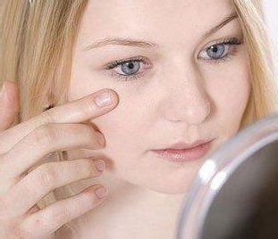 美瞳佩戴方法 美瞳眼结石 戴美瞳患眼结石 专家讲述佩戴美瞳的危害