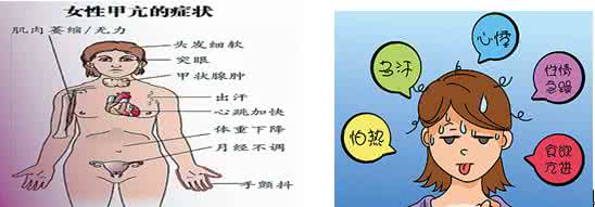 甲亢发病原因 甲亢发病的原因是什么 白癜风发病原因是什么？