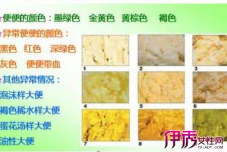 小儿消化不良怎么办 宝宝消化不良大便图 怎样从大便的性质判断小儿的消化功能?