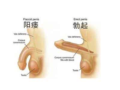 阴茎勃起困难晨勃很好 导致男性阴茎晨勃的原因有哪些