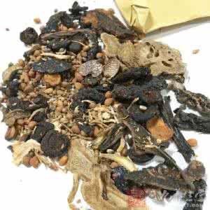 尿道损伤的临床表现 尿道痒 它的临床表现是什么