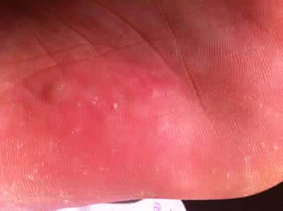 怀孕摸到硬块生男孩 摸到胸部有硬块 这是怎么回事