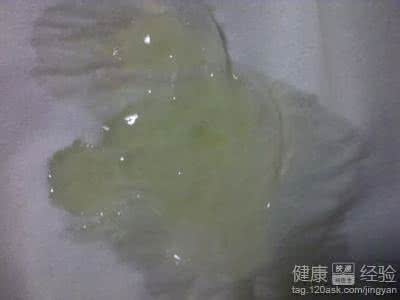 男性尿液发黄有异味 男性精液的颜色发黄是什么情况