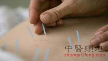 戒烟针灸有用吗 戒烟针灸
