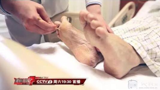 脑溢血救命绝招 【脑溢血救命绝招!】