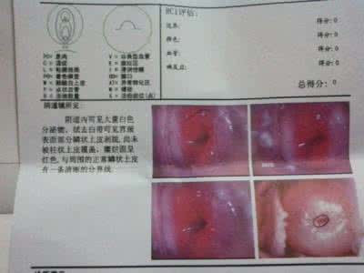 盆腔积水什么原因 盆腔积水 盆腔积水属于什么科室？