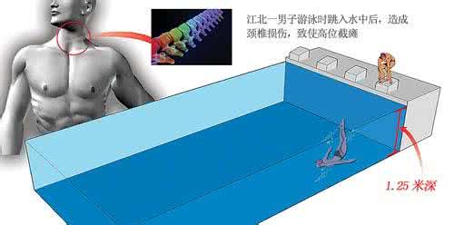 抖抖机真的能损伤内脏 注意跳水不当伤内脏