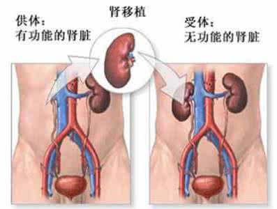 肾移植后感冒吃什么药 肾移植感冒了什么办？