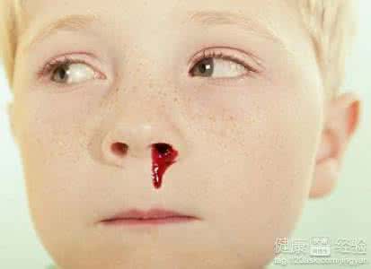小孩鼻出血偏方大全 小孩鼻出血怎么办