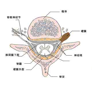 蛛网膜下腔出血治疗 蛛网膜下腔出血是什么 治疗方法是啥