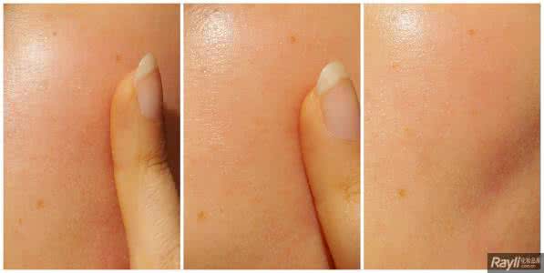 软化角质层 软化皮肤角质层用什么？