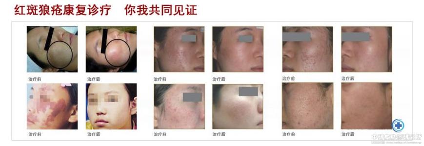 常见皮肤病自诊自疗 常见皮肤病自诊自疗 常见的皮肤病 皮肤病知识介绍