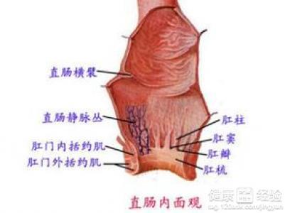 慢性肥大性直肠炎 不可不知 直肠炎的5大病症