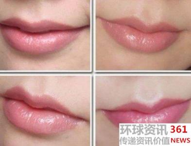过敏性唇炎用什么药 过敏性唇炎 什么是过敏性唇炎