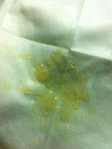 男人的精子可以面膜吗? 可以用刚射出的精液做精液面膜么
