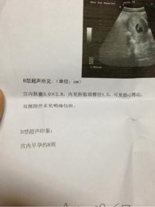 男科医院不能说的秘密 医院里不能说的秘密,如何通过B超单预知宝宝的性别!!