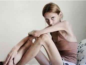 神经性厌食症 神经性厌食症治疗 厌食症的调理方法 做到这些帮你治疗厌食症