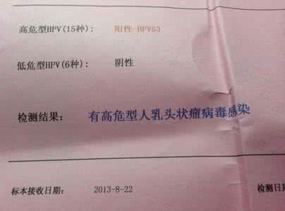 白带发黄有味 白带发黄有味是怎么回事呢
