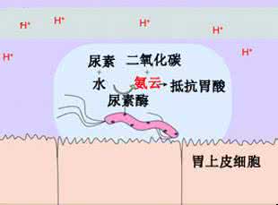 如何治慢性胃病 胃病怎么养 幽门螺旋杆与胃病的关系