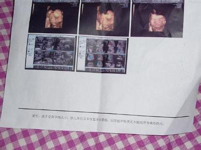 孕晚期胎心监护看男女 胎心监护看男女 不用B超——如何猜出宝宝性别_胎心监护看男女