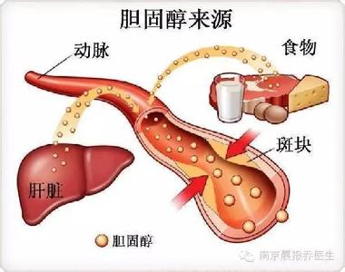 胆固醇逃出黑名单 胆固醇已被撤下黑名单？其实多是人体自己造！