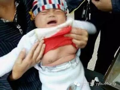 小孩性早熟表现 小孩性早熟表现 为什么小孩性早熟呢