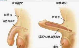 治疗勃起障碍的药物 告诉你勃起障碍的药物大全