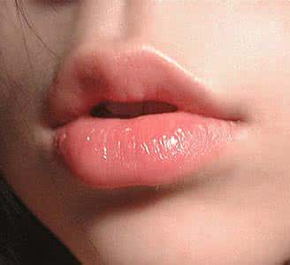 上火烂嘴角怎么治 烂嘴角不是上火是病毒