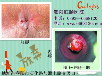 拉大便出血是怎么回事 大便出血怎么回事 大便出血如何治疗