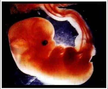 生物的遗传和变异 遗传、变异和怪胎