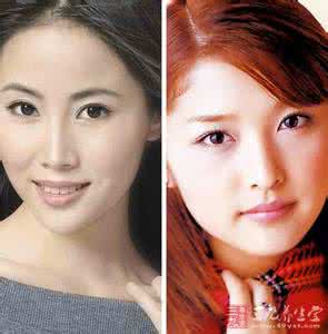 白化病是什么遗传 白化病是什么 全面了解白化病(3)_白化病是什么
