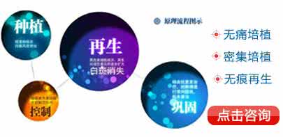 精神病遗传概率 精神病遗传概率 白癜风遗传概率有多少？谈白癜风遗传概率