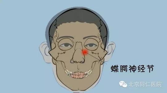 治疗鼻炎最有效的方法 有鼻炎的那个人希望你能看到 省钱又有效